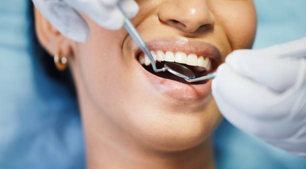 Best Urgent Care for Lost Fillings or Crowns in Grissom Af, IN
