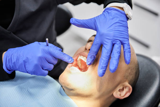 Best Emergency Treatment for Dental Infections or Abscesses in Grissom Af, IN