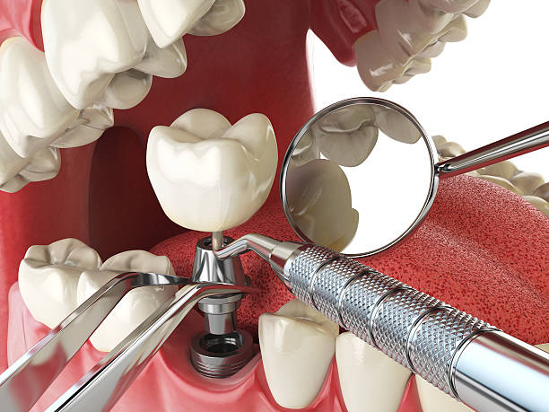 Best Cosmetic Emergency Dentistry in Grissom Af, IN